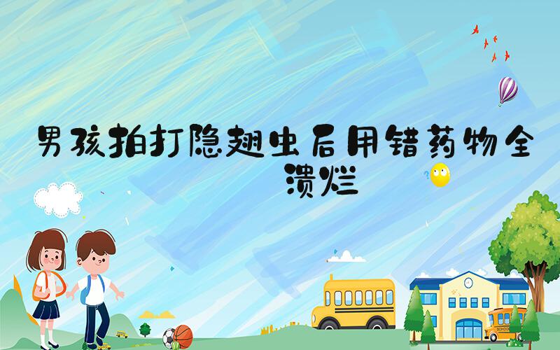 男孩拍打隐翅虫后用错药物全身溃烂