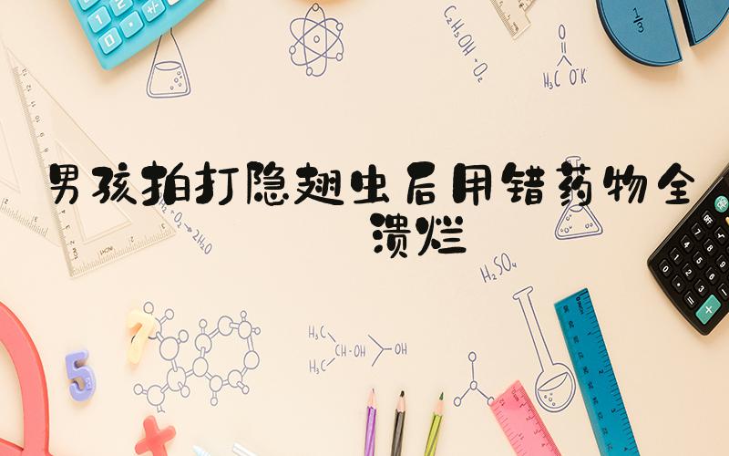 男孩拍打隐翅虫后用错药物全身溃烂