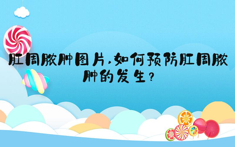 肛周脓肿图片 如何预防肛周脓肿的发生？
